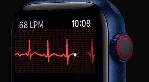 cueva gene corazón perdido Reloj ECG electrocardiograma, tensiómetro y oxímetro » Smartwatch Comparador
